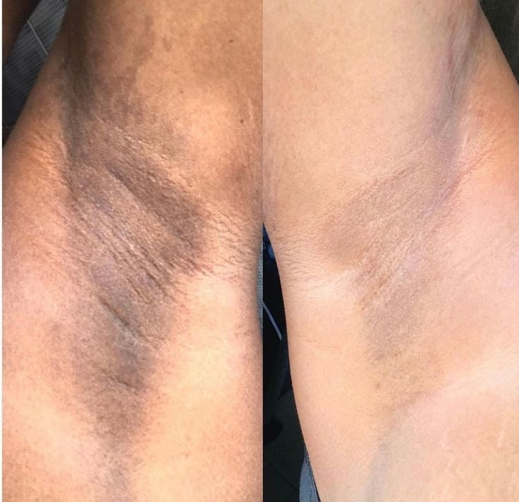 Toning solution